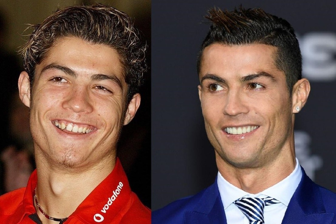 Ronaldo va dan sao Hollywood len doi nhan sac nho lam rang hinh anh