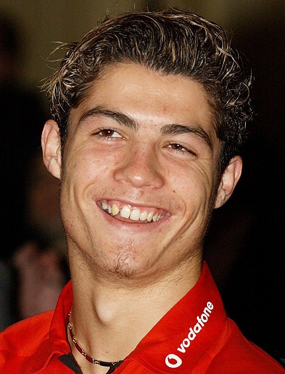 ronaldo làm răng ảnh 1 ronaldo lam rang anh 1
