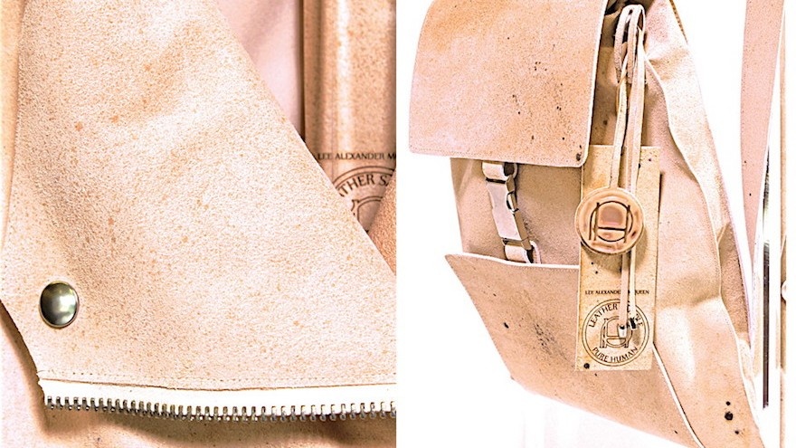 tui xuong nguoi anh 3