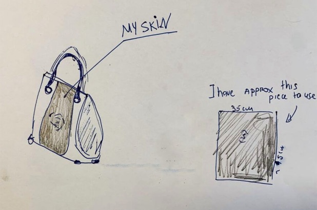 tui xuong nguoi anh 2