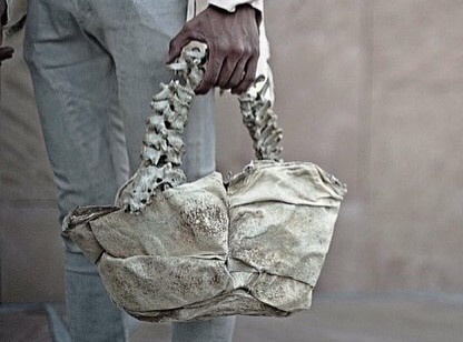 tui xuong nguoi anh 1