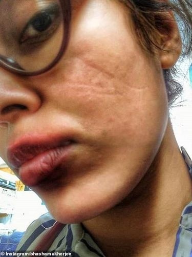 da mat xau vi deo khau trang anh 2