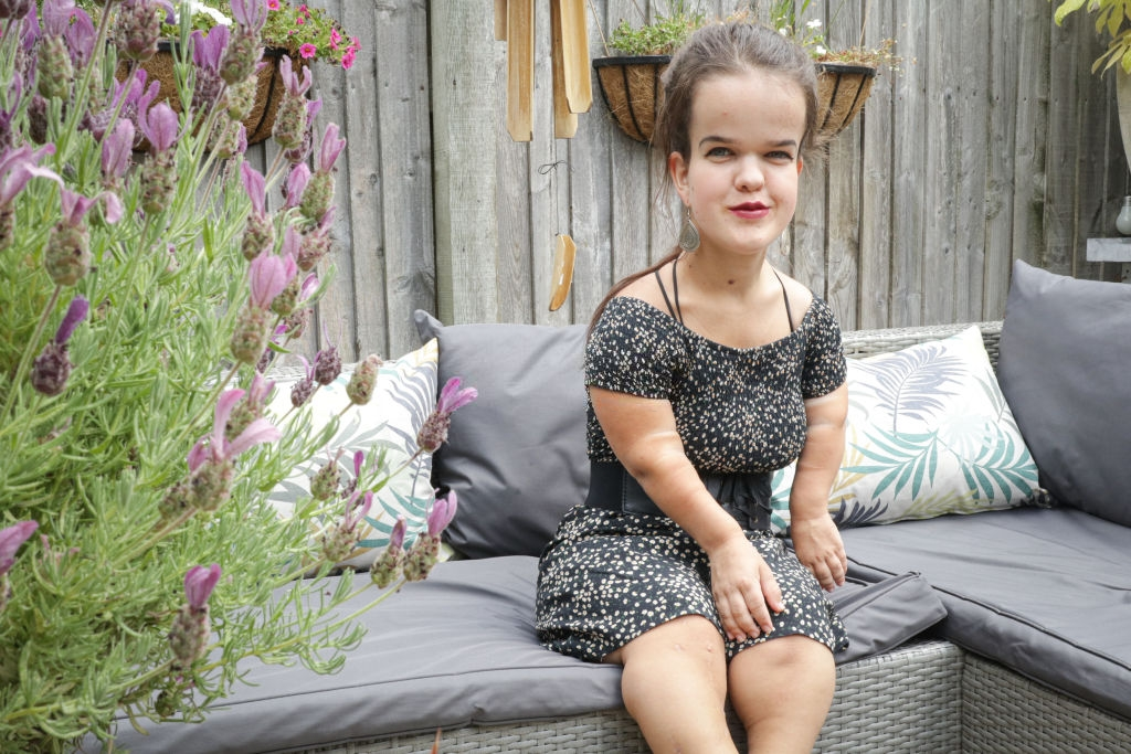 cach phoi do cho nguoi lun anh 1