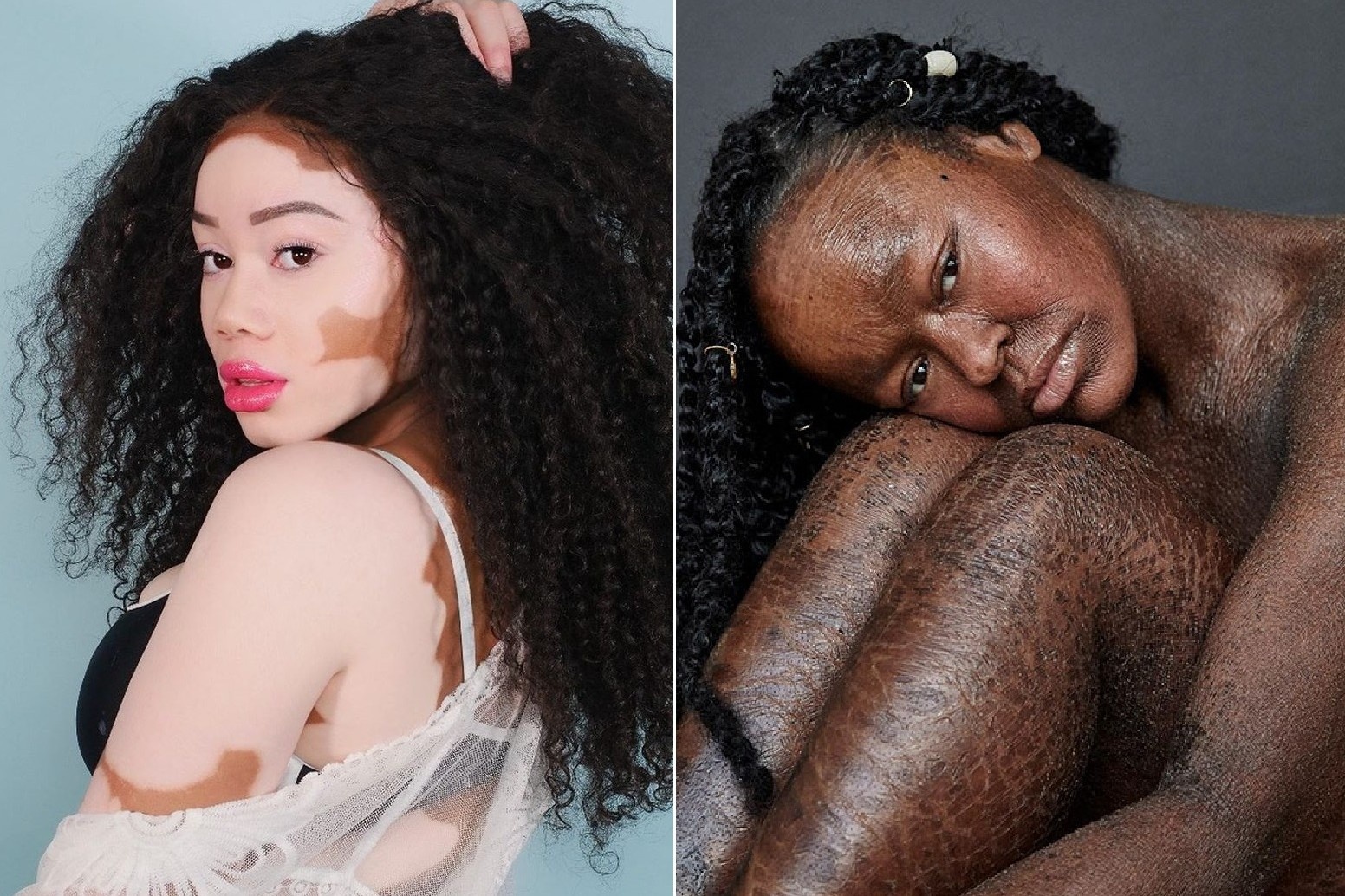 5 nguoi mau co ve dep vuot moi chuan muc tren the gioi hinh anh