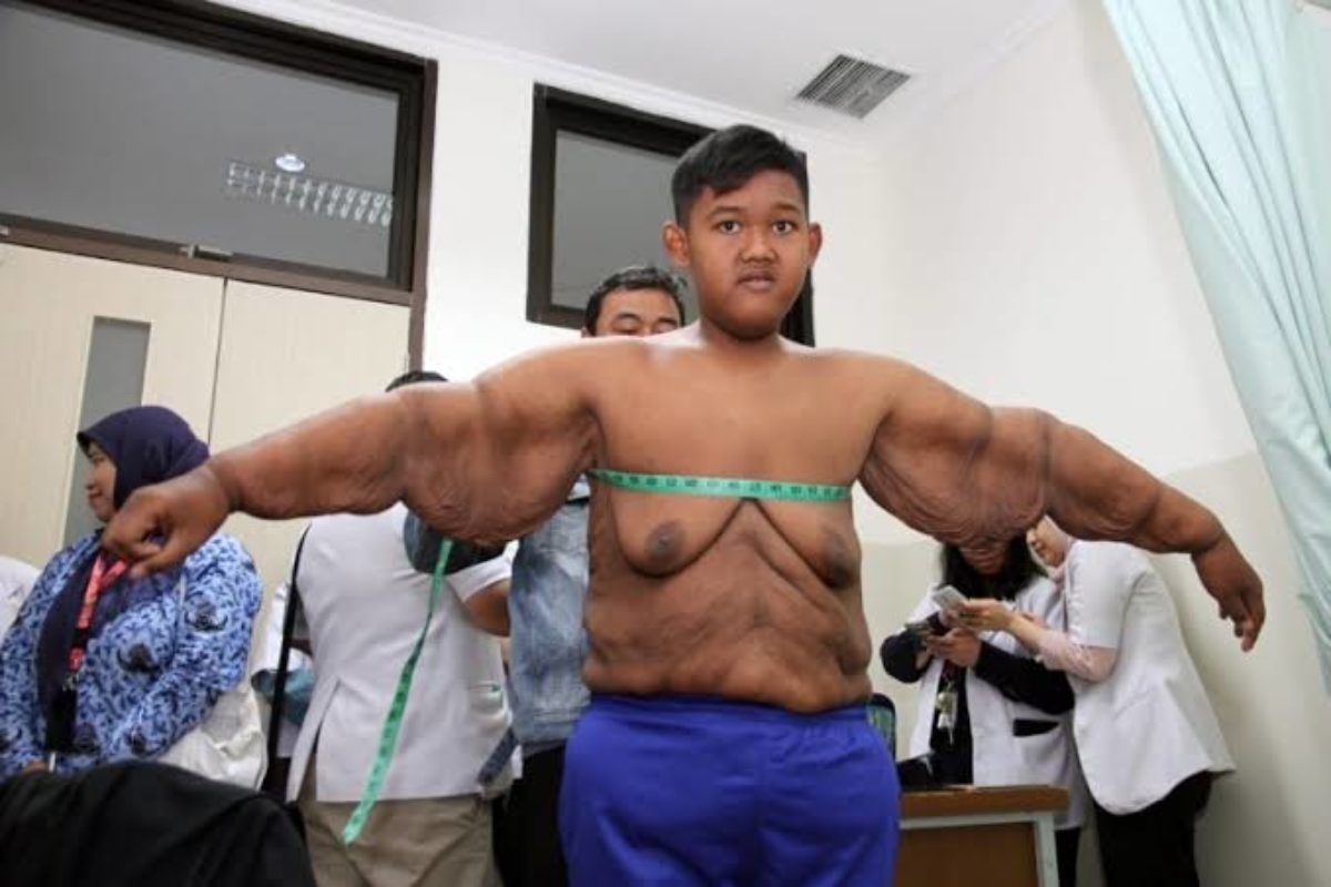 giam beo nhanh anh 2