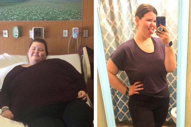 giam beo nhanh anh 4