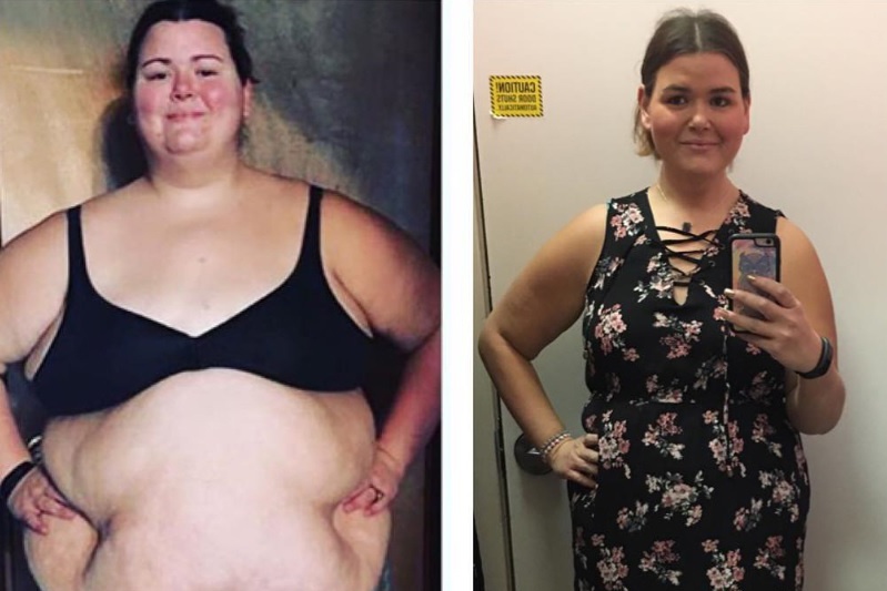 giam beo nhanh anh 3