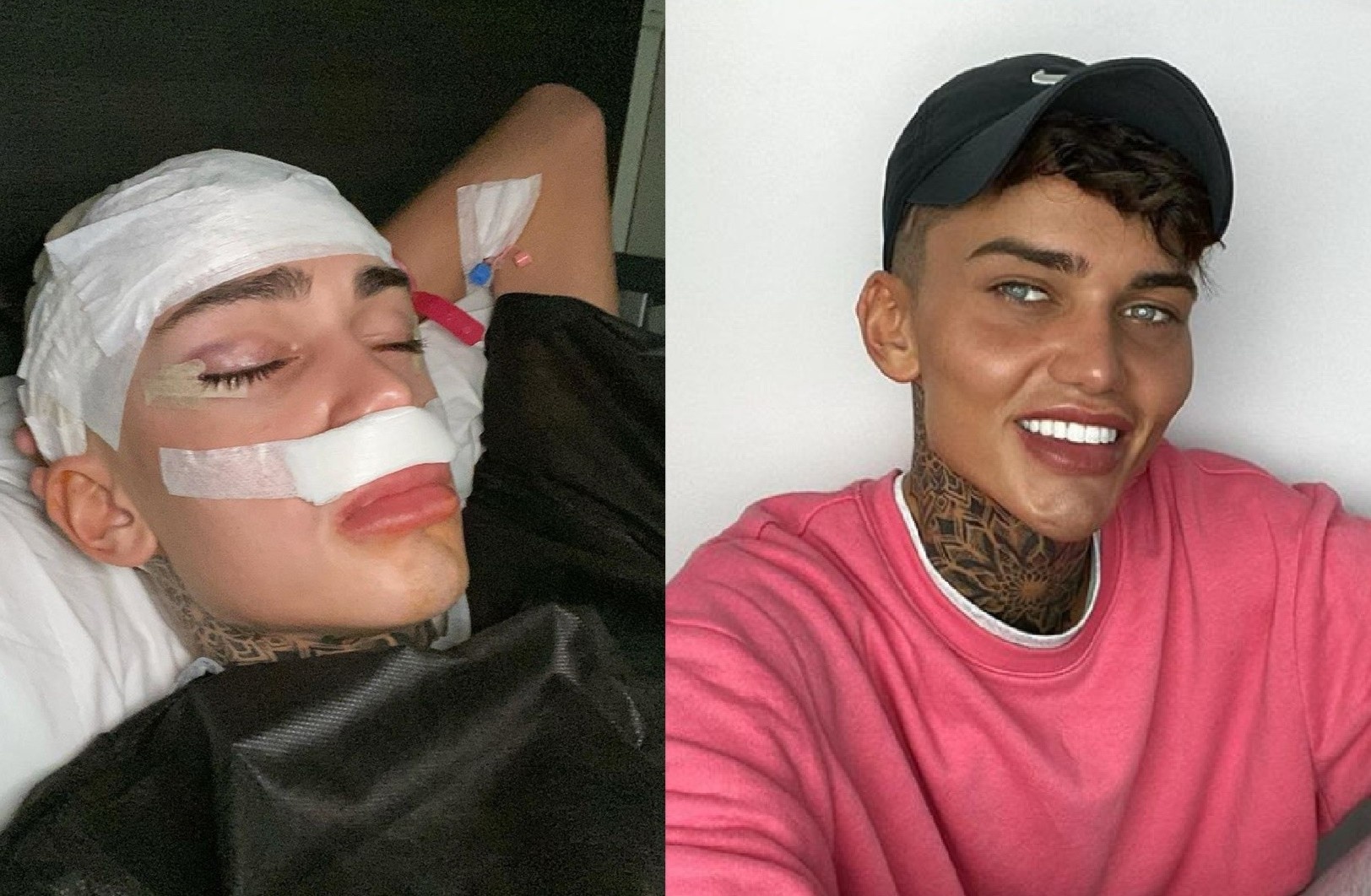 9X chi 25.000 USD de phau thuat giong anh tren mang hinh anh