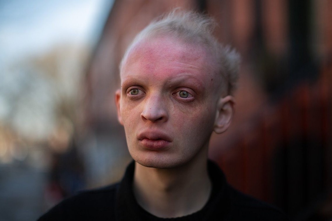 9X mac benh ma ca rong tro thanh nguoi mau hinh anh