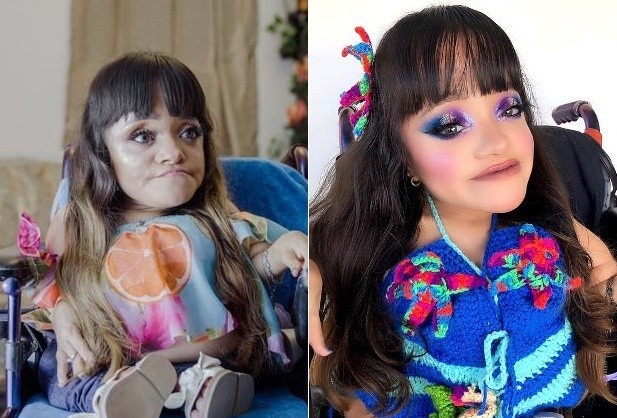 Tho trang diem 29 tuoi bi che xau, mac benh xuong thuy tinh hinh anh