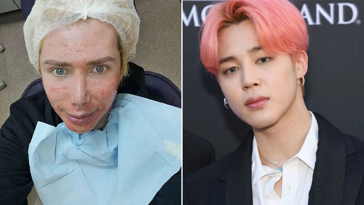 phau thuat tham my dep anh 2