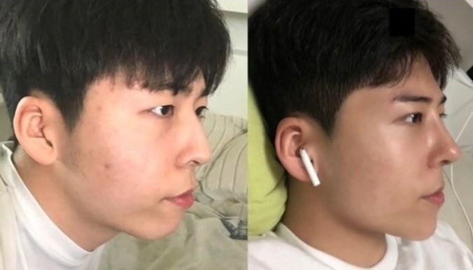 phau thuat tham my dep anh 1