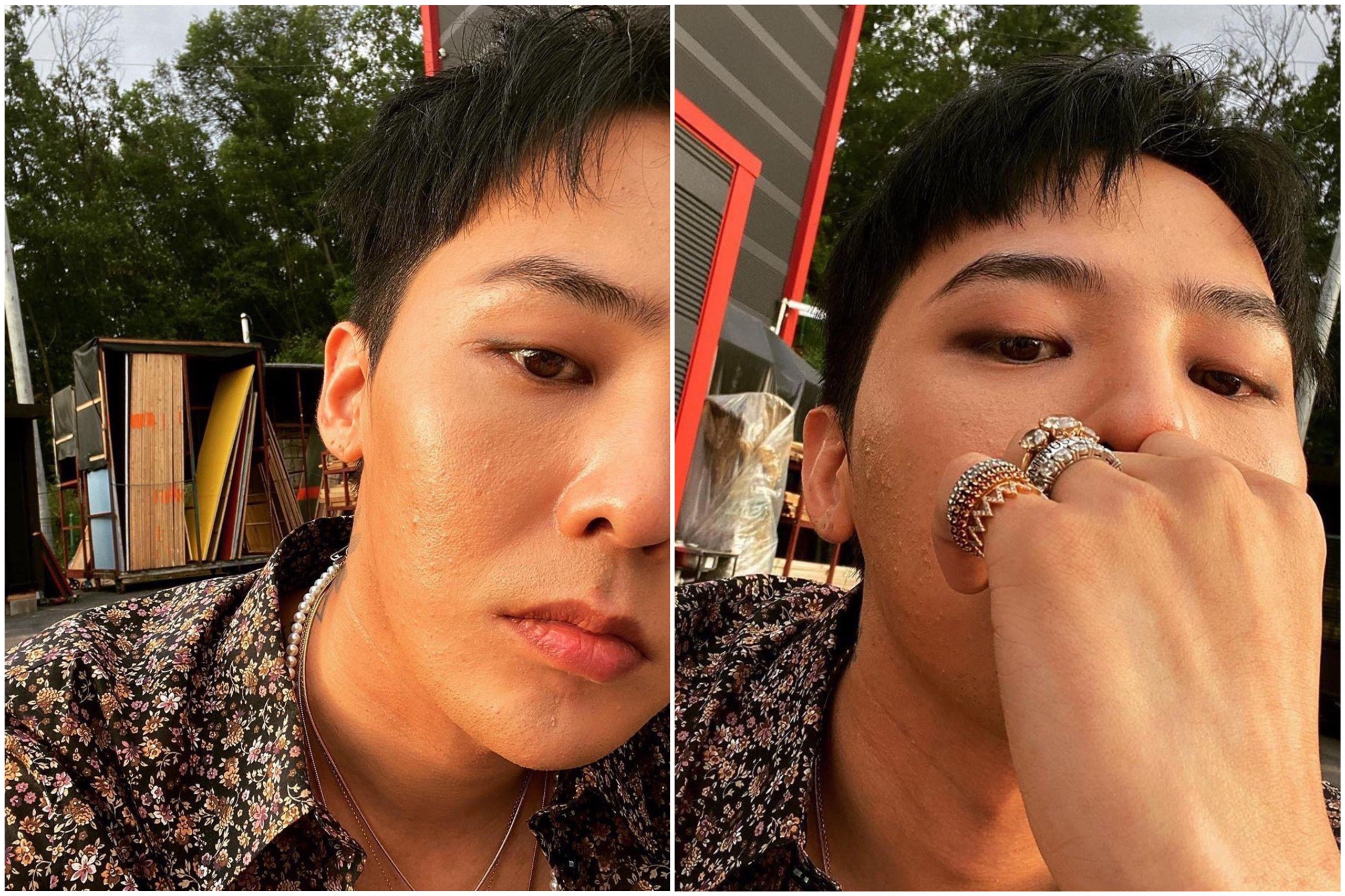 khoe mặt mụn ảnh 4 khoe mat mun anh 4