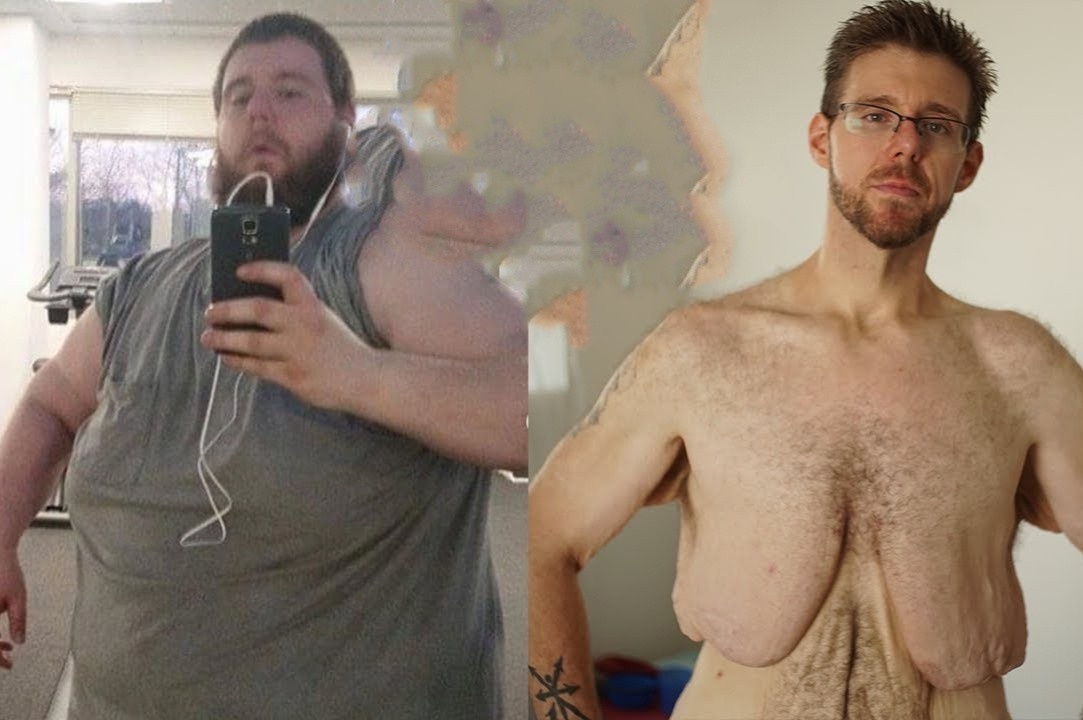 Nguoi dan ong giam 146 kg sau khi bi ban gai bo hinh anh