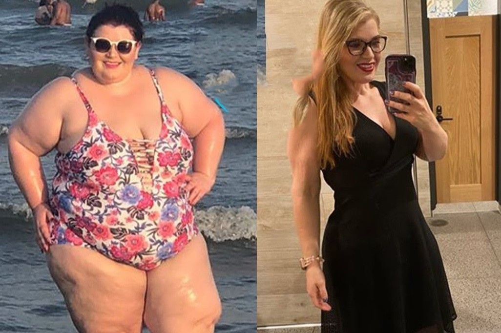 Nguoi phu nu doi doi nho giam 87 kg hinh anh