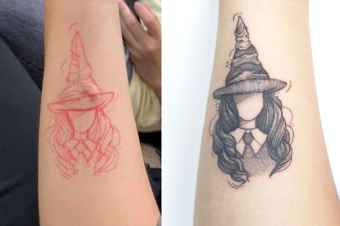 Chang trai Ha Noi xam hinh len vet seo o tay hinh anh