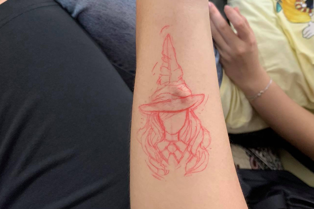 xăm sẹo hà nội ảnh 5 xam seo ha noi anh 5