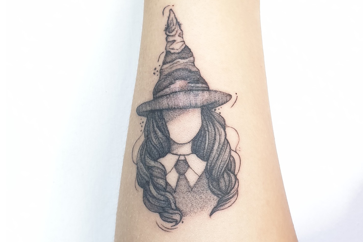 xăm sẹo hà nội ảnh 6 xam seo ha noi anh 6