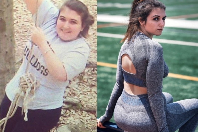 Co gai phau thuat cat da day de lam nguoi mau hinh anh