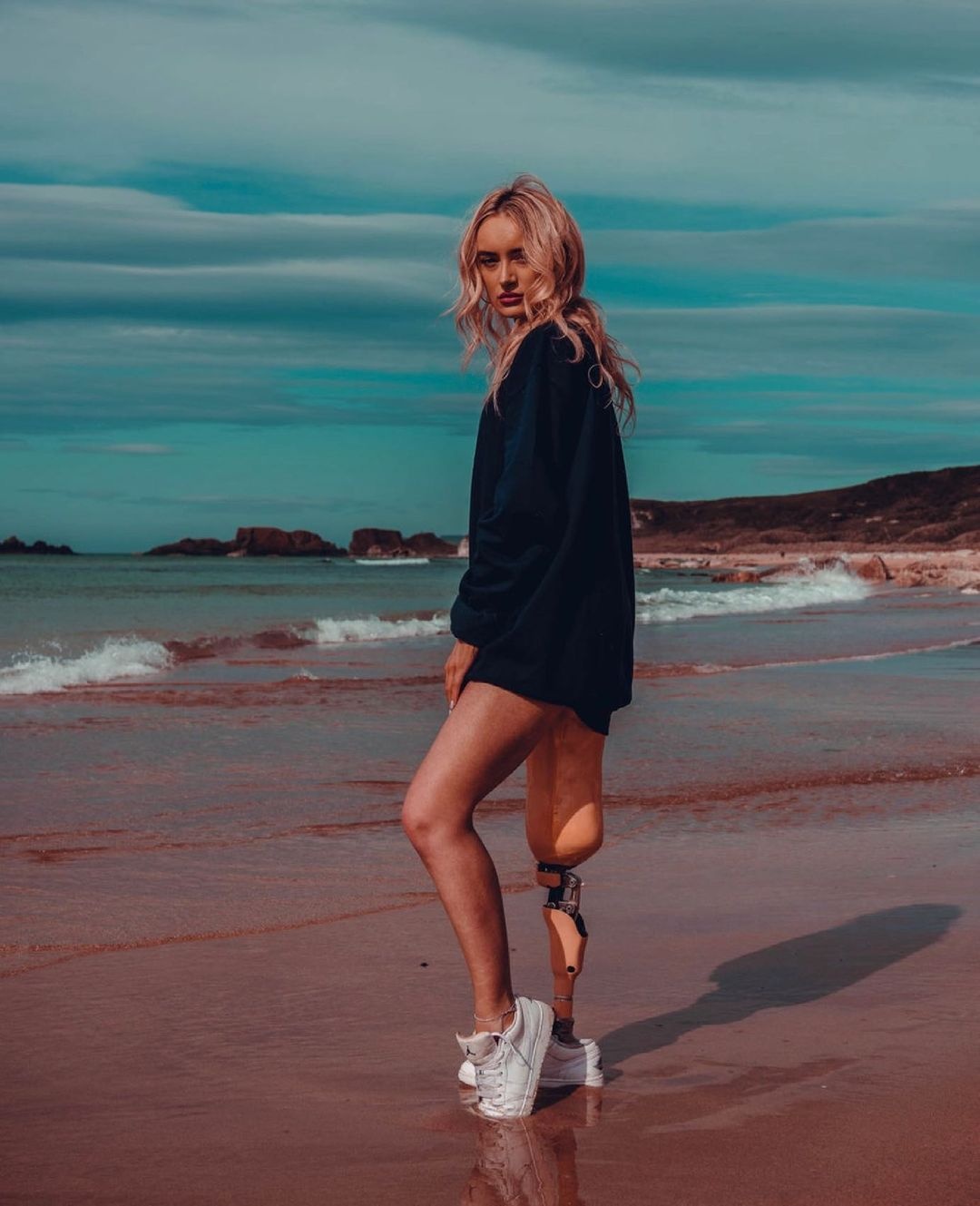 người mẫu cụt chân ảnh 5 nguoi mau cut chan anh 5