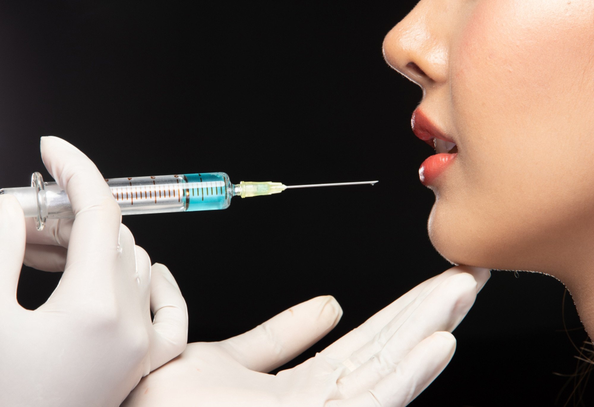 phau thuat tham my anh 2