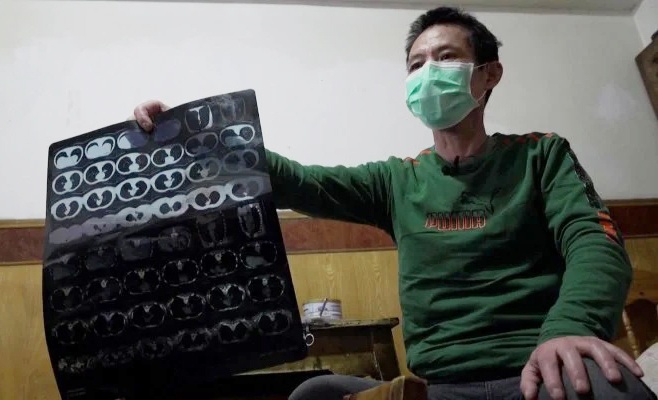 Benh nhan nhiem Covid-19 tai Vu Han tung am tinh gia 3 lan hinh anh