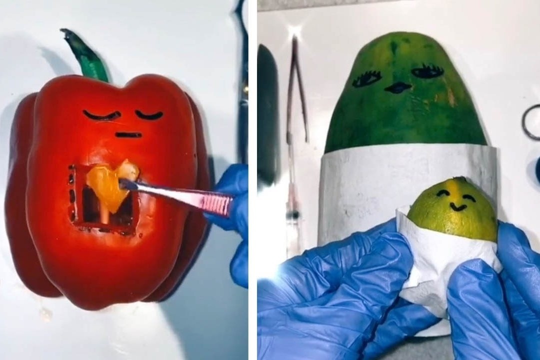 Co be 12 tuoi thich phau thuat trai cay hinh anh