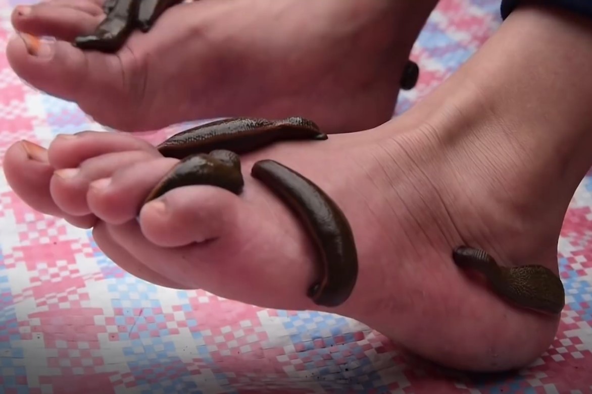 Truyen thong tri lieu bang dia hang nghin nam o Kashmir hinh anh