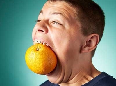 Cau be 16 tuoi co mieng rong nhat the gioi hinh anh