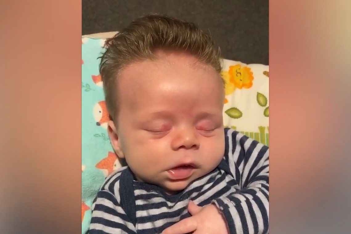 Be trai 5 tuan tuoi co mai toc bong muot hinh anh