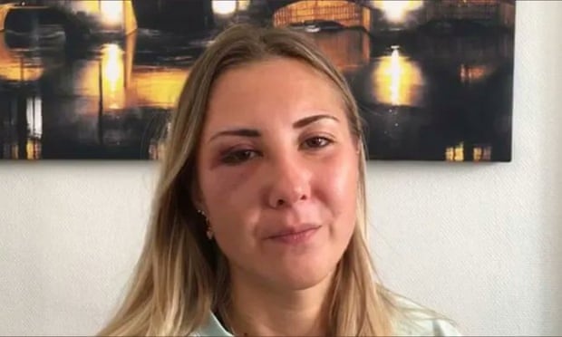 Nguoi phu nu bi tan cong vi mac vay ngan tai Phap hinh anh