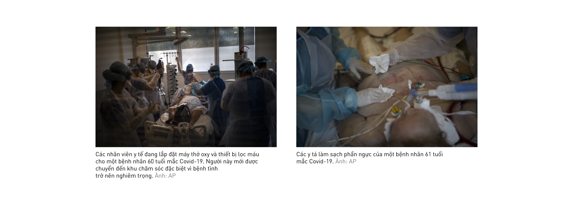 Benh vien Phap trai qua nhung ngay dau thuong nhat anh 6