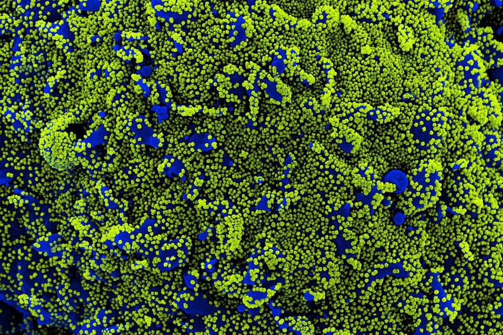 Hien tuong bi an cua benh nhan mac Covid-19 hinh anh