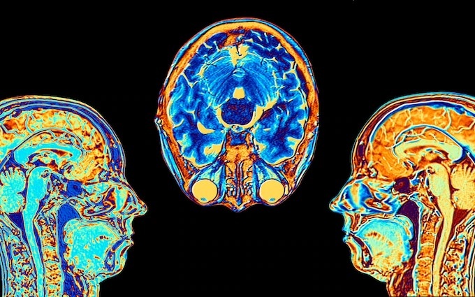 Van dong qua it khien chung ta gia di nhanh hon hinh anh