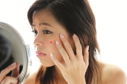 Tai sao mun trung ca hoanh hanh? hinh anh