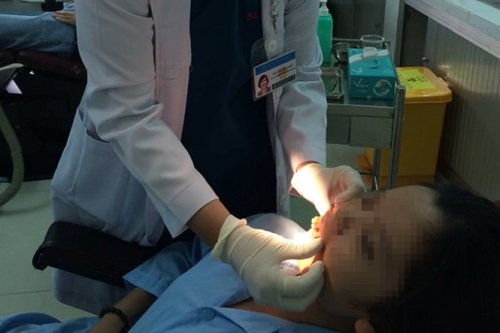 Khi rang lech, lung lay hinh anh