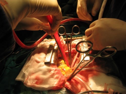 Một tuần sau mổ, hiện nay bệnh nhân này đã hoàn toàn bình phục, có thể tự đi lại, đọc sách, tự ăn uống...