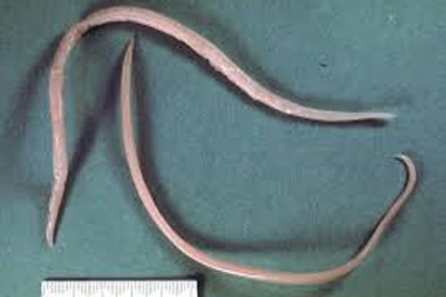 Loai giun ki sinh nguoi Viet de mac va cach phong tranh hinh anh