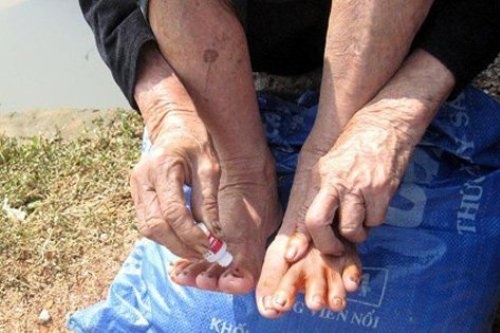 De phong nuoc an chan hinh anh