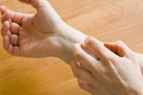 10 bai thuoc tri ghe de ap dung hinh anh