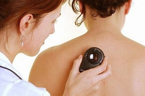 Cach phan biet mun nhot thong thuong va ung thu da hinh anh