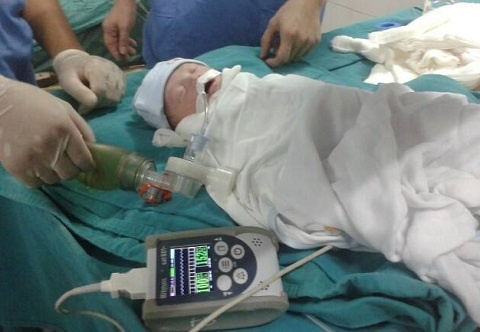 Ca cap cuu hiem gap: Mo lay con tu nguoi me bong 98% hinh anh