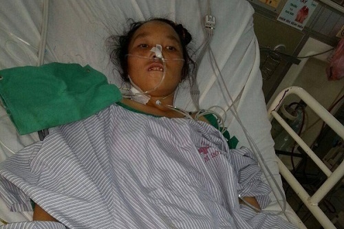 Kinh hoang phat hien 40 con giun trong ong mat chu benh nhan hinh anh