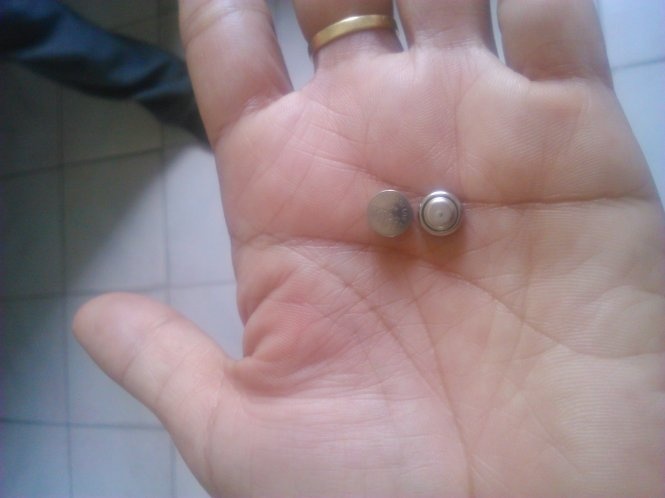 Cục pin gắn lồng đèn phát sáng, có nhạc mà bé C. nhét vào mũi - Ảnh: T.Lũy