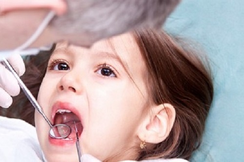 Hau qua khon luong khi nan chinh rang khong dung cach hinh anh