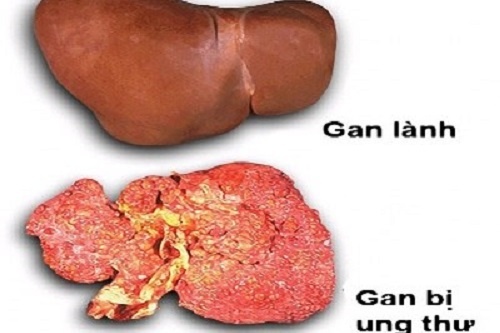 200 benh nguy hiem co nguyen nhan tu mot loai 'van hoa' xau hinh anh