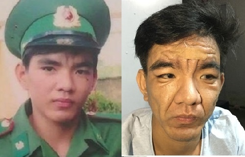 Chuyen gia ly giai can benh nguoi tre bien thanh ong, ba lao hinh anh