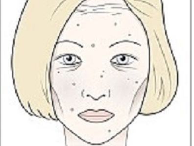 Khuon mat thay doi nhu the nao khi uong ruou, an duong? hinh anh