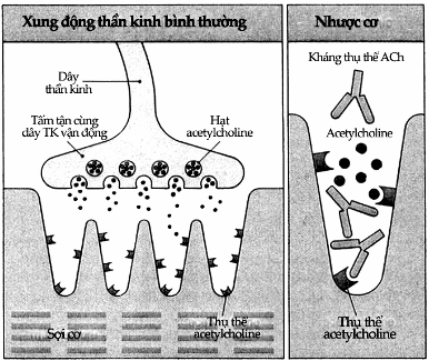 Cơ chế bệnh nhược cơ.