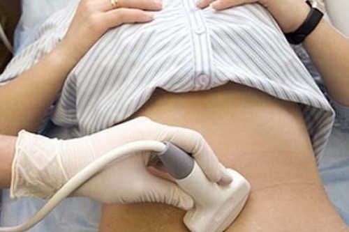 Cach phat hien som khoi u phu khoa hinh anh